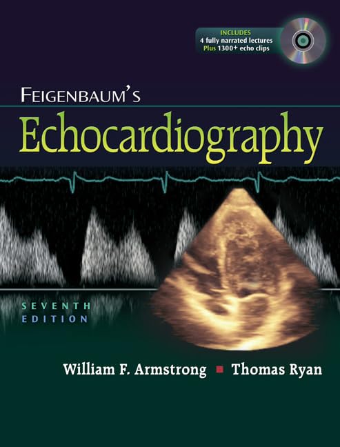 Feigenbaum's Echocardiography - Very Good