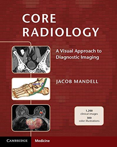 Core Radiology: A Visual Approach to Diagnostic Imaging, Paperback, 1 Edition by Mandell, Jacob