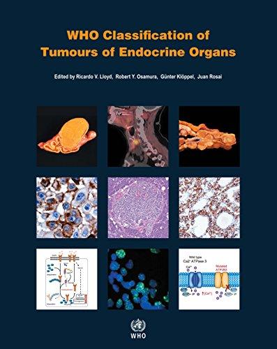 WHO Classification of Tumours of Endocrine Organs (Medicine), Paperback, 4 Edition by WHO Classification of Tumours Editorial Board