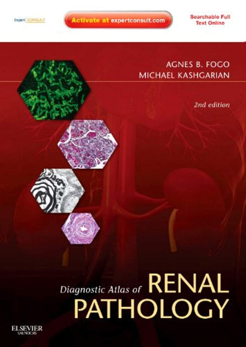 Diagnostic Atlas of Renal Pathology: Expert Consult - Online and Print, Hardcover, 2 Edition by Fogo MD, Agnes B. (Used)