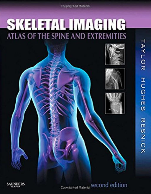 Skeletal Imaging: Atlas of the Spine and Extremities, Hardcover, 2 Edition by John A. M. Taylor